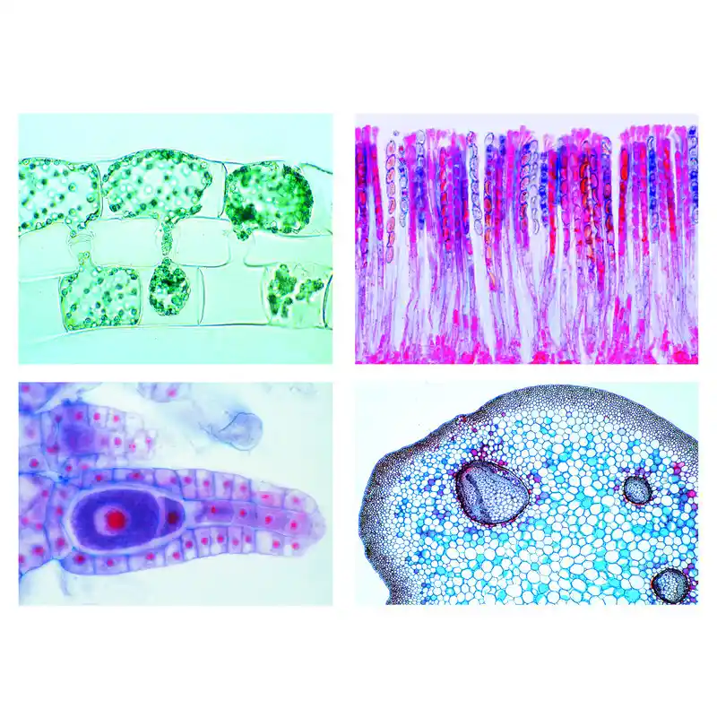 LIEDER Cryptogamae, Elementary Set